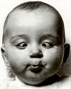 蘭州眼科專家：孩子是對(duì)眼，媽媽很緊張