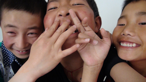 “明眸格?；P(guān)愛(ài)玉樹(shù)眼疾兒童行動(dòng)”11名玉樹(shù)眼疾患兒成功