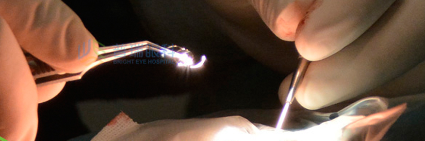 老人看不清，霧蒙蒙，視力逐漸下降這有可能是白內(nèi)障眼病