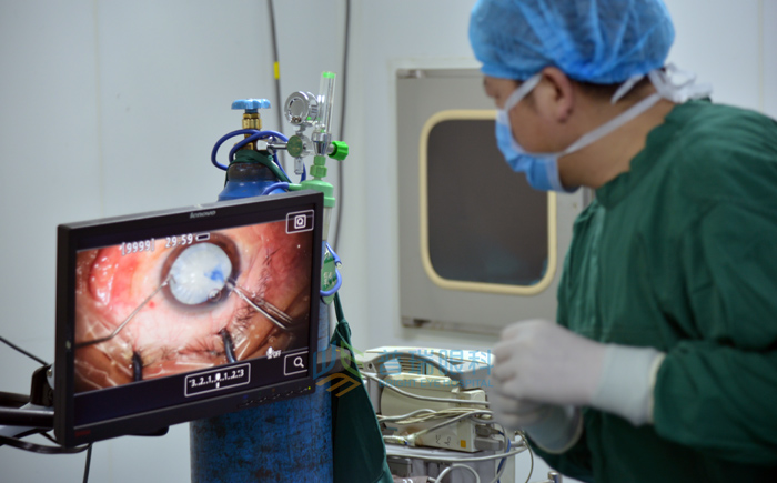 文字版，白內障手術過程要看看哦