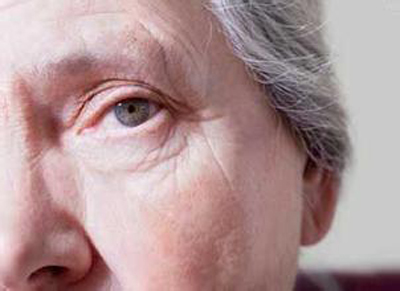 快給父母測測:有沒有白內(nèi)障眼病