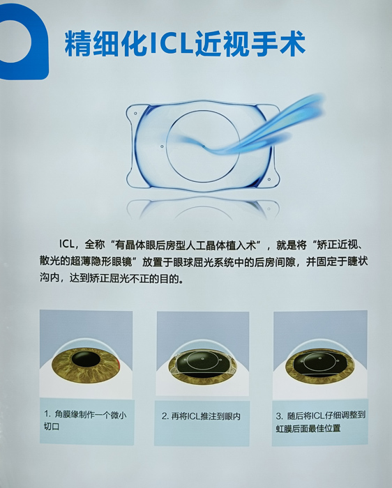 寒假摘鏡總動(dòng)員，近視朋友的三種矯正近視方式